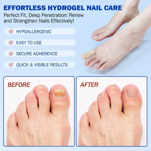 Original Fungal Nail Treatment Patches™