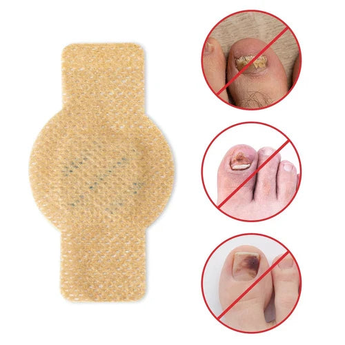 Original Fungal Nail Treatment Patches™