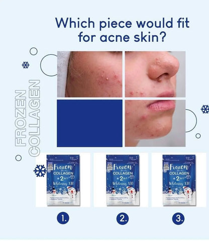 Frozen Collagen 2-in-1 Whitening – 60 Capsules