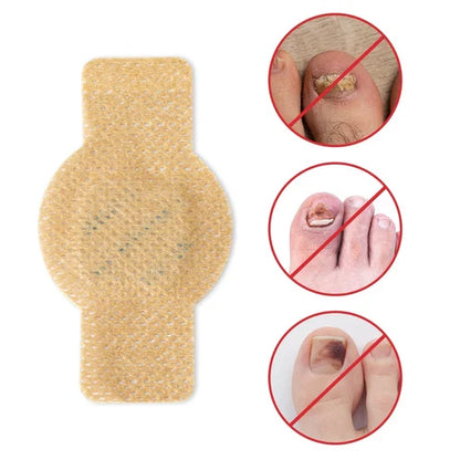 Original Fungal Nail Treatment Patches™
